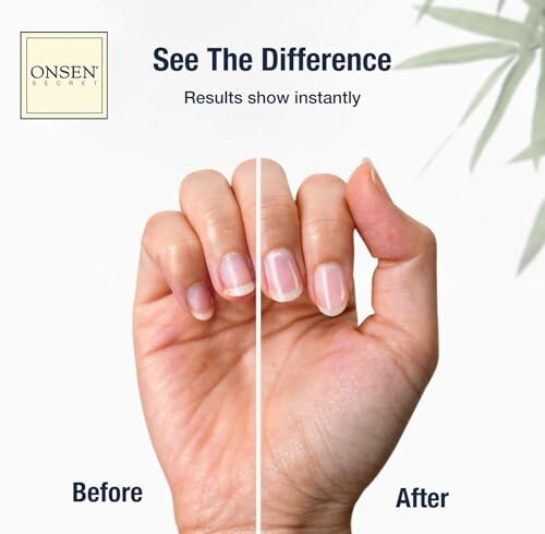 Hand showcasing before and after nail treatment.